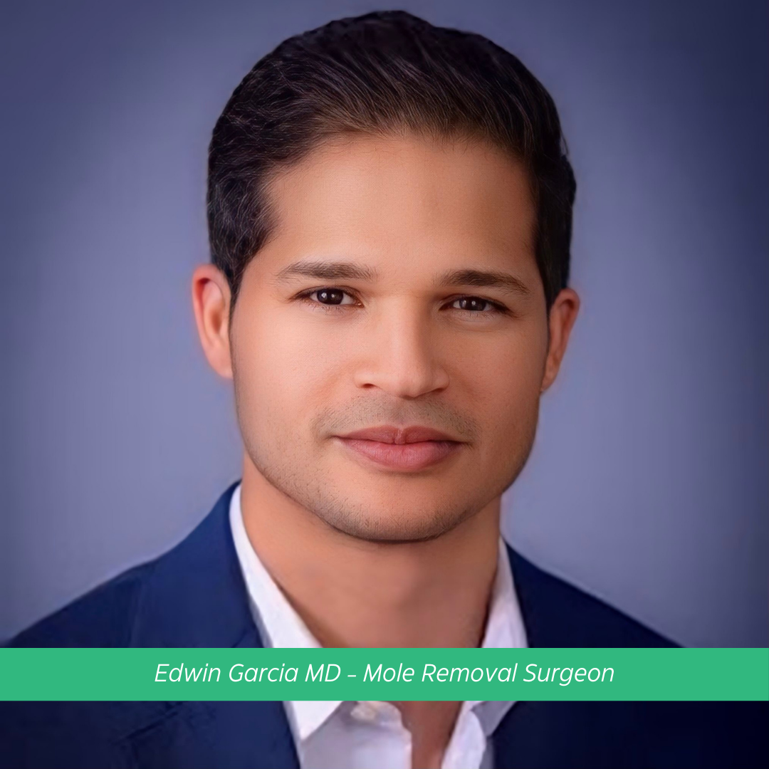 Edwin Garcia mole removal burbank doctor