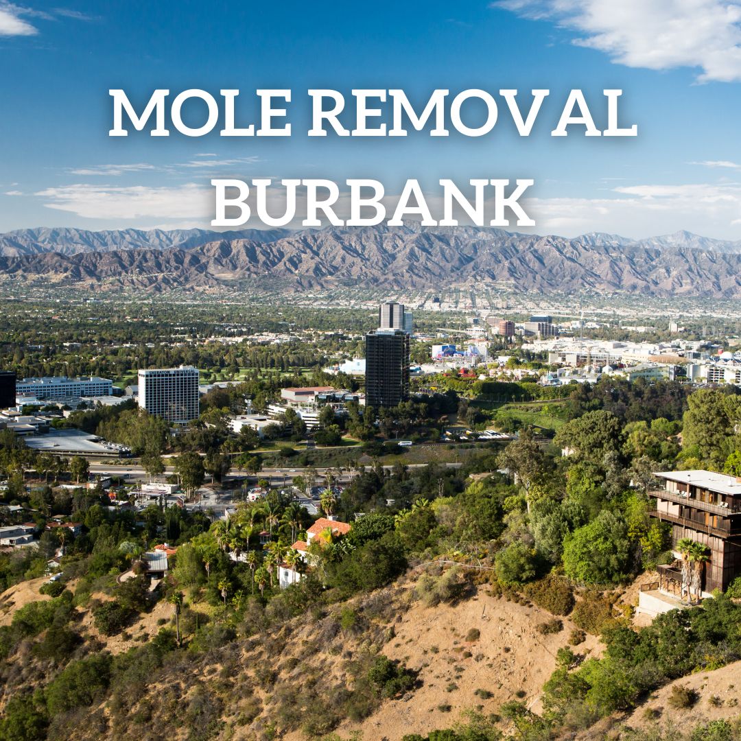 mole removal burbank ca