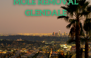 mole removal Glendale ca