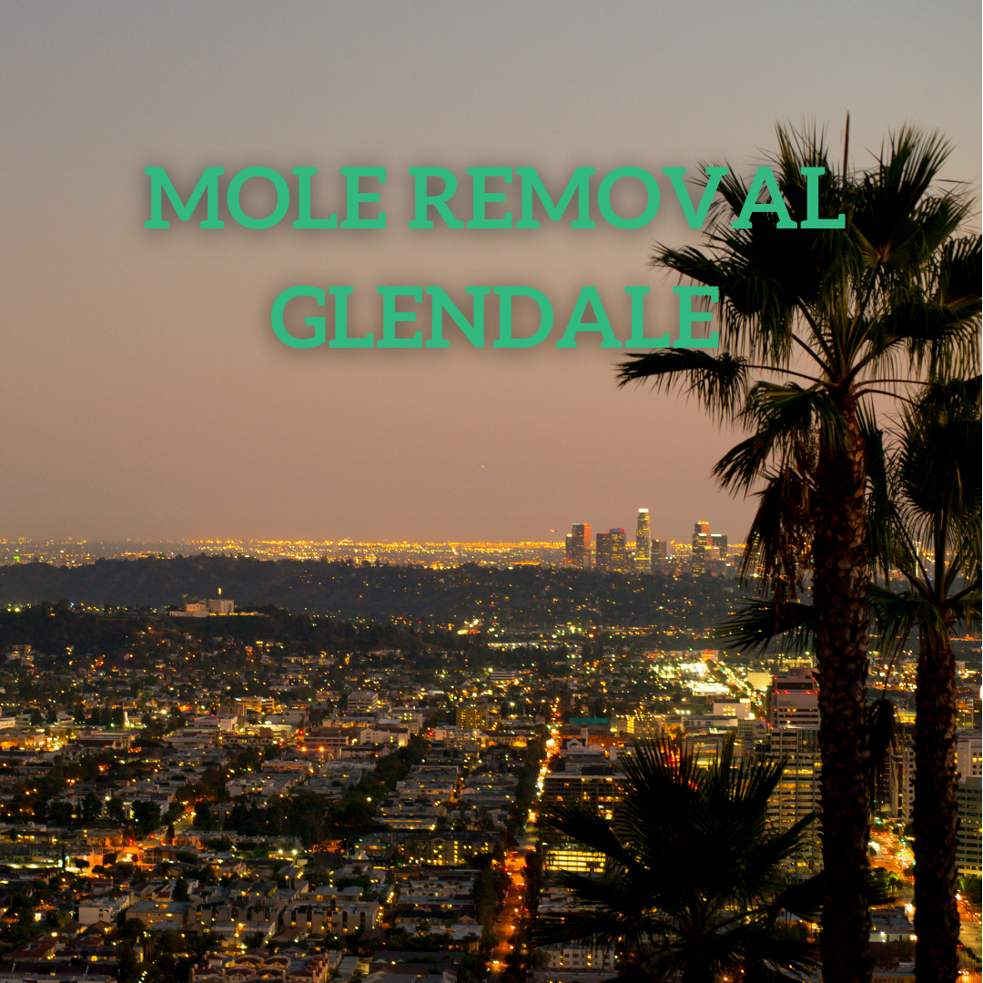 mole removal Glendale ca
