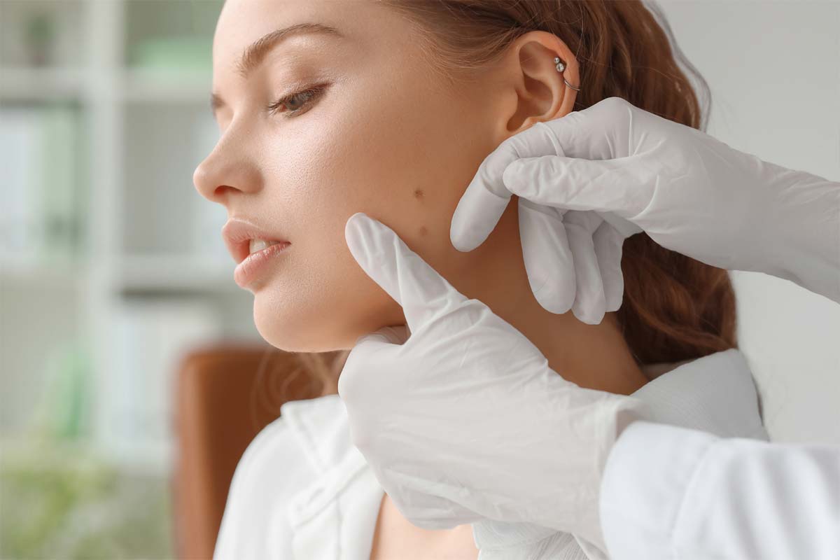 affordable mole removal norwalk california